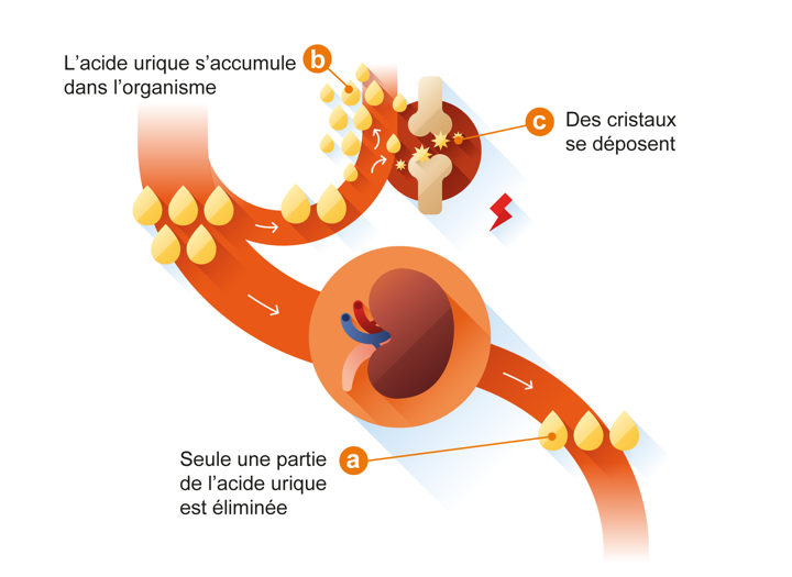 Seule une partie de l acide urique est eliminee